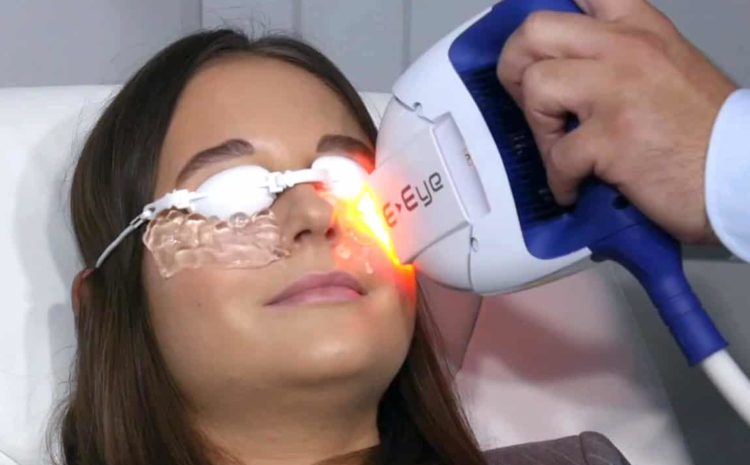  4 tratamentos eficazes para o olho seco relacionado ao glaucoma