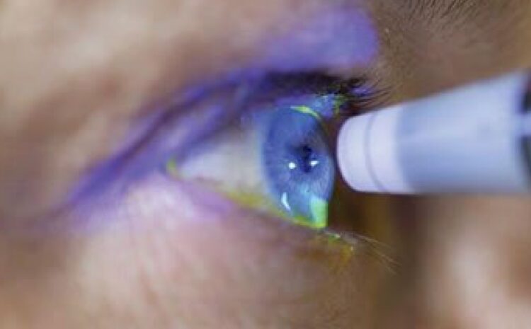  O que é hipertensão ocular? Qual a relação com o glaucoma?