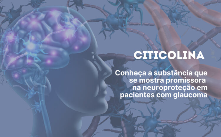  O que é citicolina e como ela ajuda no tratamento do glaucoma