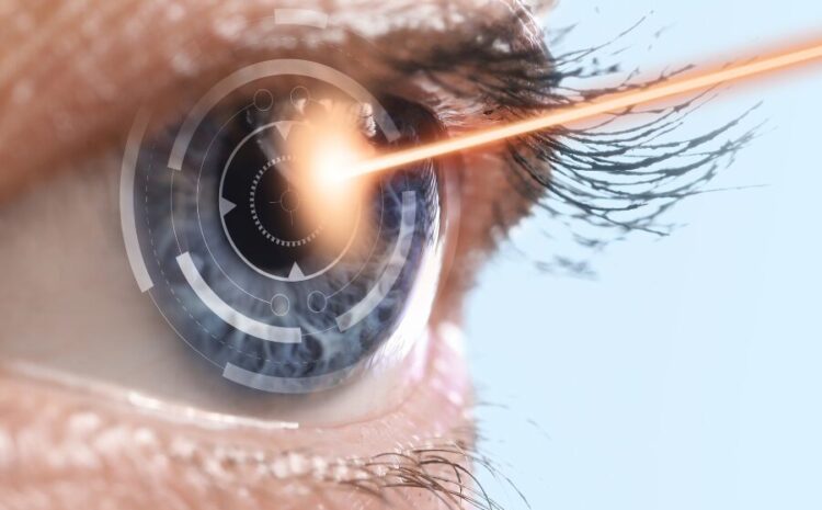  Cirurgia de Catarata a Laser – Como funciona Onde Fazer em SP