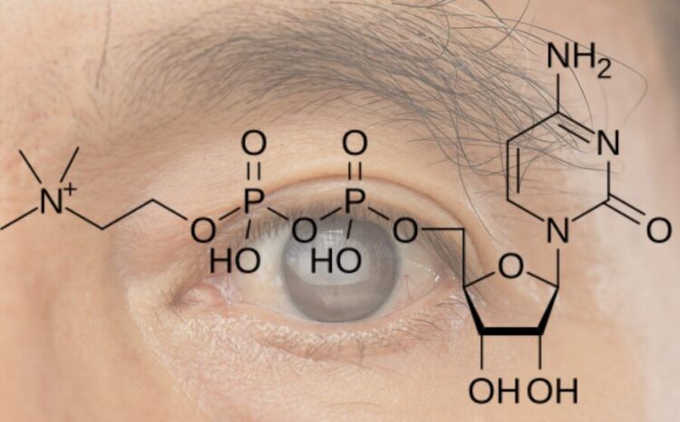  Citicolina para tratamento do glaucoma: o que é, como funciona e o que dizem os estudos