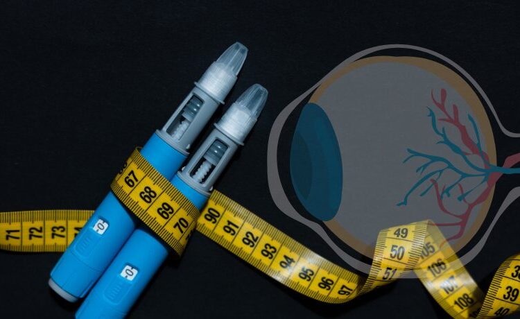  GLP-1 pode proteger contra glaucoma? O que os estudos mais recentes mostram